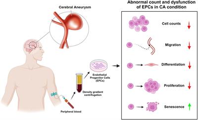 Potential role of endothelial progenitor cells in the pathogenesis and treatment of cerebral aneurysm